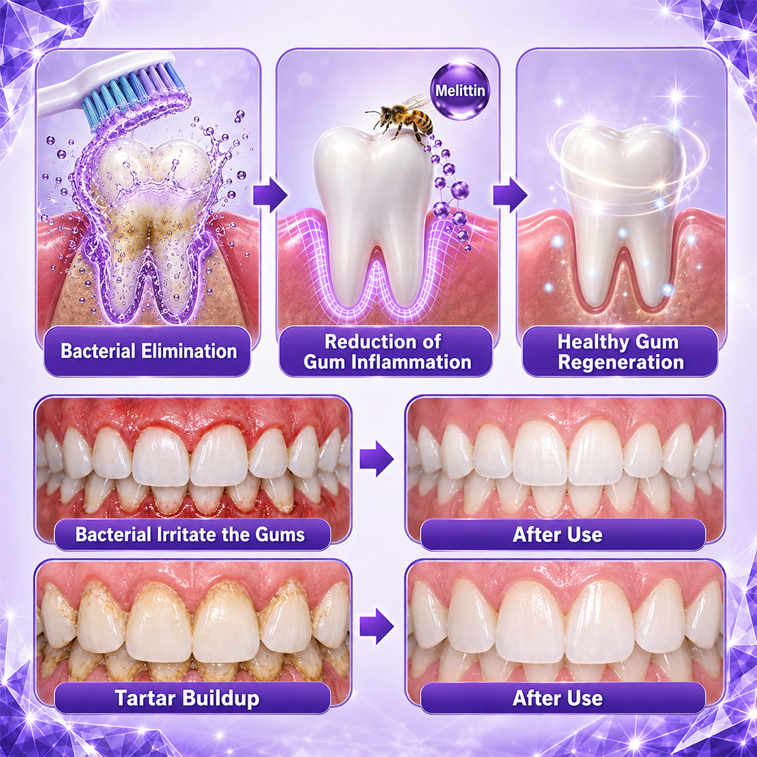 Timlk® Gingivitis Periodontal Treatment Toothpaste2
