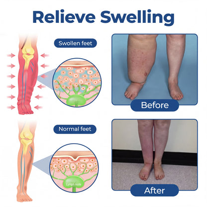 Timlk® Varicose Veins Cream