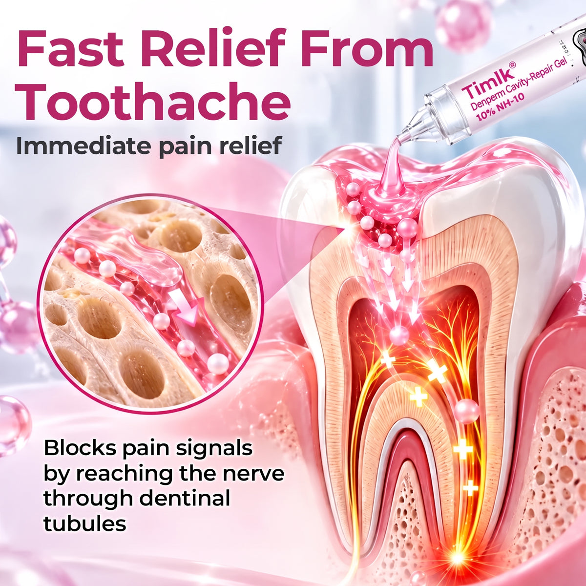 Timlk® DenPerm Cavity-Repair Natural Enamel Filling Gel