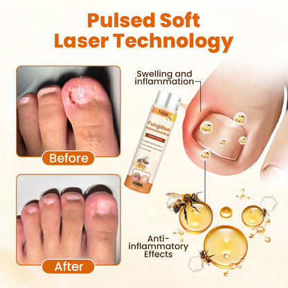 Timlk® FungiBee Advanced Nail Repair Spray