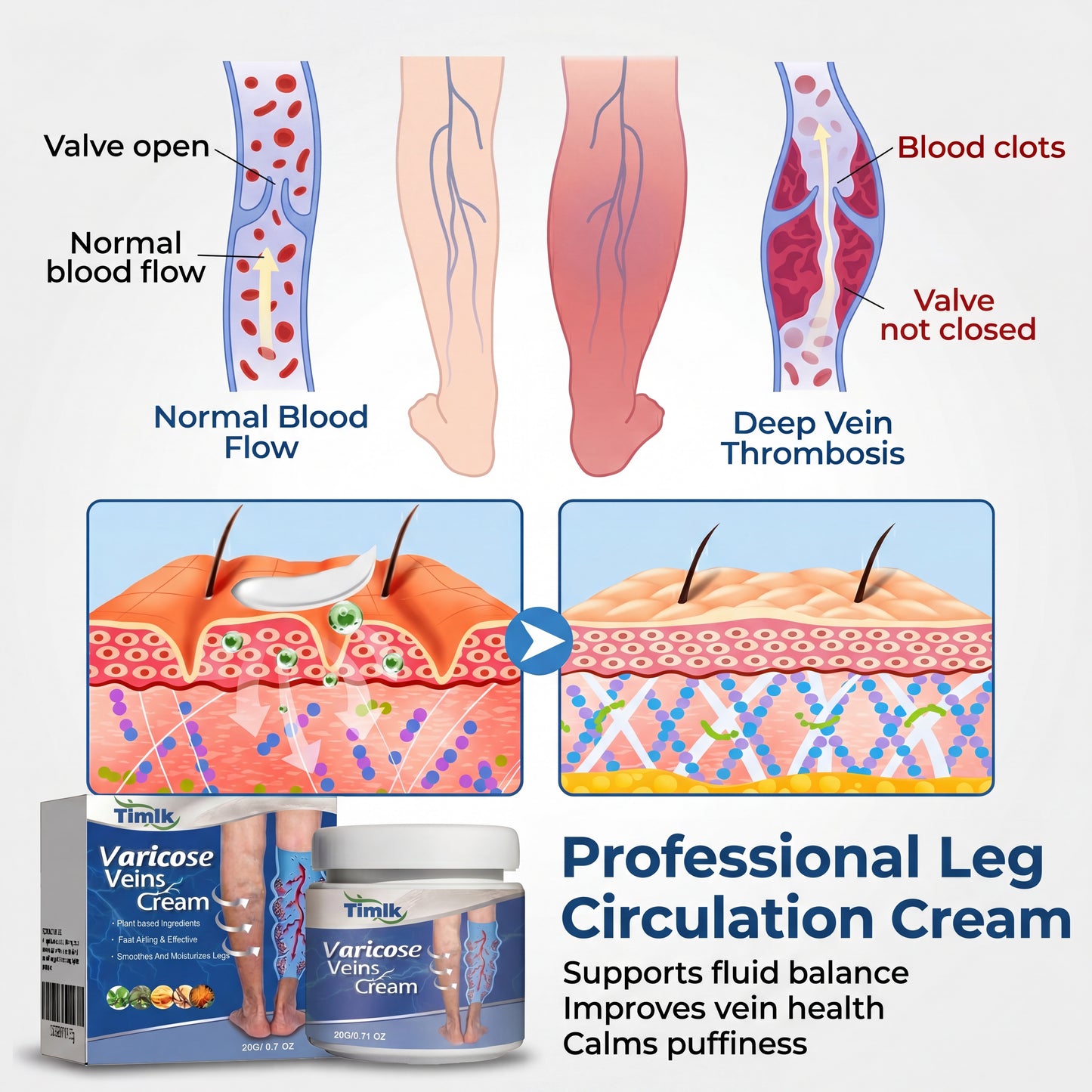 Timlk® Varicose Veins Cream