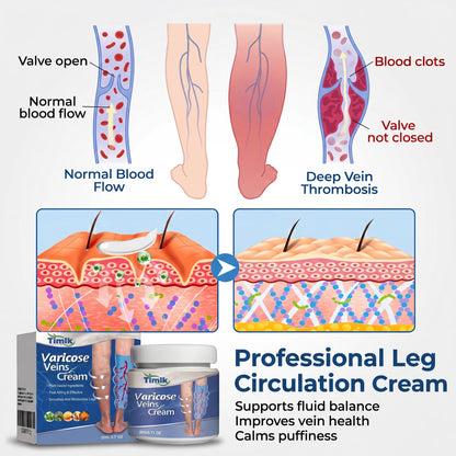 Timlk® Varicose Veins Cream