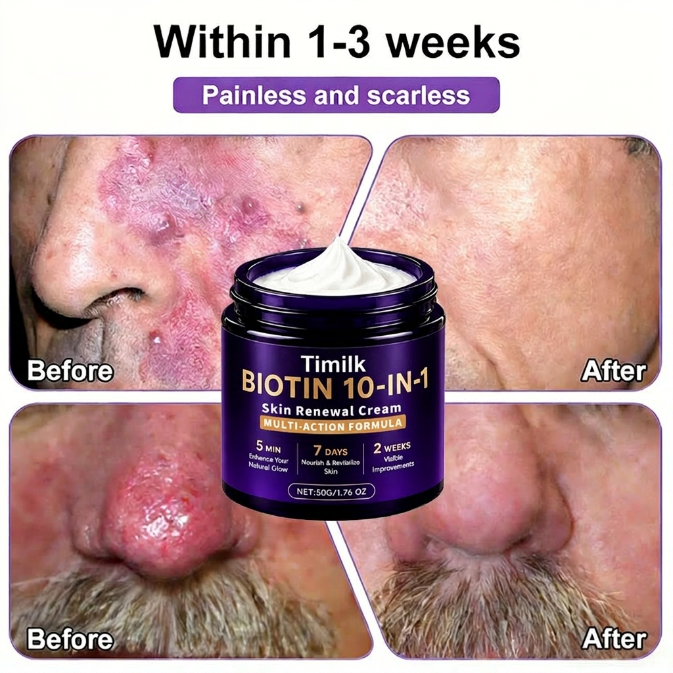 🔥LAST DAY 50% OFF - Timilk® Biotin 10-in-1 Skin Restoration Cream