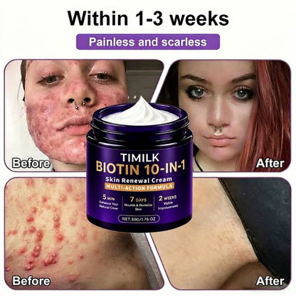 🔥LAST DAY 50% OFF - Timilk® Biotin 10-in-1 Skin Restoration Cream