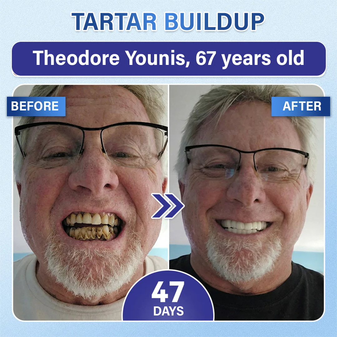 Your Smile🦷Timilk® Tooth & Gum Repair Fast-Dissolving Microneedle Patch✨ (𝟓-𝐢𝐧-𝟏 💎 𝐑𝐞𝐛𝐮𝐢𝐥𝐝 𝐄𝐧𝐚𝐦𝐞𝐥 & 𝐃𝐞𝐧𝐭𝐢𝐧 • 𝐒𝐭𝐫𝐞𝐧𝐠𝐭𝐡𝐞𝐧 𝐆𝐮𝐦𝐬 • 𝐄𝐫𝐚𝐝𝐢𝐜𝐚𝐭𝐞 𝐓𝐚𝐫𝐭𝐚𝐫 & 𝐎𝐝𝐨𝐫 • 𝐖𝐡𝐢𝐭𝐞𝐧𝐢𝐧𝐠 • 𝐒𝐭𝐨𝐩 𝐓𝐨𝐨𝐭𝐡 𝐒𝐞𝐧𝐬𝐢𝐭𝐢𝐯𝐢𝐭𝐲)