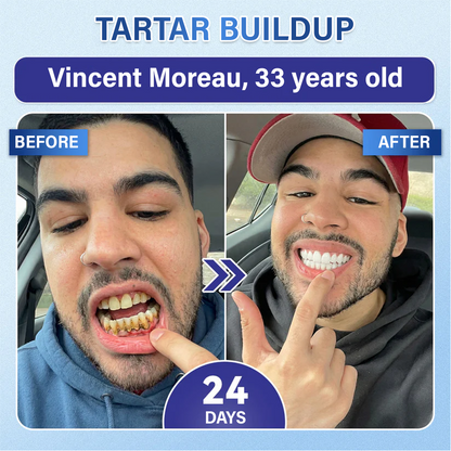 Your Smile🦷Timilk® Tooth & Gum Repair Fast-Dissolving Microneedle Patch✨ (𝟓-𝐢𝐧-𝟏 💎 𝐑𝐞𝐛𝐮𝐢𝐥𝐝 𝐄𝐧𝐚𝐦𝐞𝐥 & 𝐃𝐞𝐧𝐭𝐢𝐧 • 𝐒𝐭𝐫𝐞𝐧𝐠𝐭𝐡𝐞𝐧 𝐆𝐮𝐦𝐬 • 𝐄𝐫𝐚𝐝𝐢𝐜𝐚𝐭𝐞 𝐓𝐚𝐫𝐭𝐚𝐫 & 𝐎𝐝𝐨𝐫 • 𝐖𝐡𝐢𝐭𝐞𝐧𝐢𝐧𝐠 • 𝐒𝐭𝐨𝐩 𝐓𝐨𝐨𝐭𝐡 𝐒𝐞𝐧𝐬𝐢𝐭𝐢𝐯𝐢𝐭𝐲)