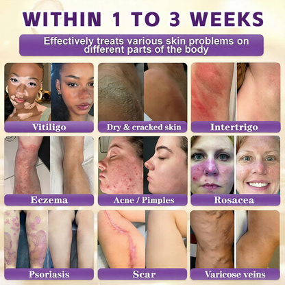 🔥LAST DAY 50% OFF - Timilk® Biotin 10-in-1 Skin Restoration Cream