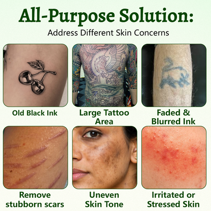 Timlk® PureAlgae Ink Removal Support Spray 🌿 — Say Goodbye to Old Tattoo Pigment 💚, Fade Stubborn Ink ✨, Repair & Smooth Treated Skin 💧, Non-Laser ✅, Try It Now! 🔥