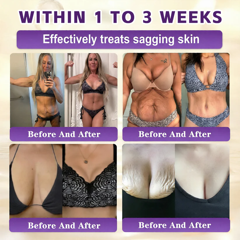 🔥LAST DAY 50% OFF - Timilk® Biotin 10-in-1 Skin Restoration Cream