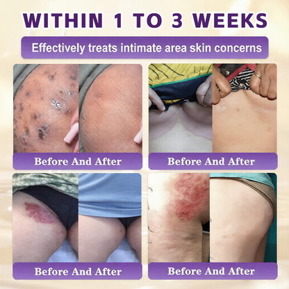 🔥LAST DAY 50% OFF - Timilk® Biotin 10-in-1 Skin Restoration Cream