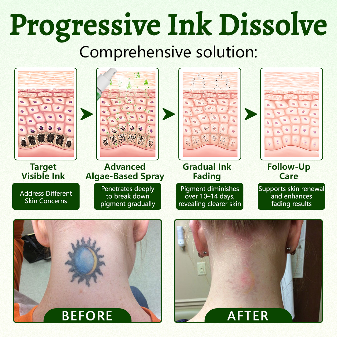 Timlk® PureAlgae Ink Removal Support Spray 🌿 — Say Goodbye to Old Tattoo Pigment 💚, Fade Stubborn Ink ✨, Repair & Smooth Treated Skin 💧, Non-Laser ✅, Try It Now! 🔥