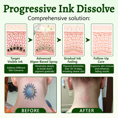 Timlk® PureAlgae Ink Removal Support Spray 🌿 — Say Goodbye to Old Tattoo Pigment 💚, Fade Stubborn Ink ✨, Repair & Smooth Treated Skin 💧, Non-Laser ✅, Try It Now! 🔥