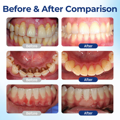 Timilk® BeeTakt Oral Repair Solution