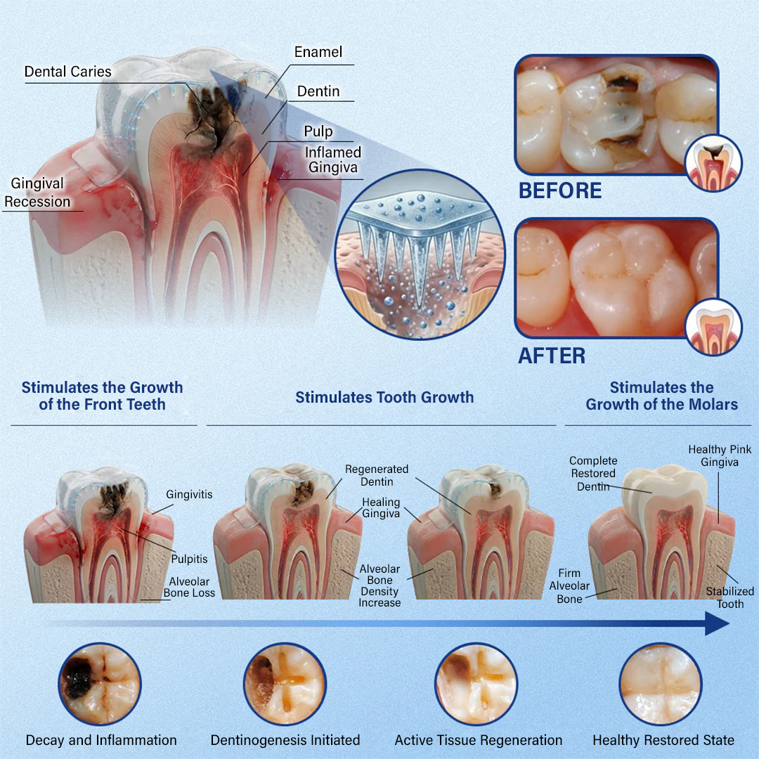 Your Smile🦷Timilk® Tooth & Gum Repair Fast-Dissolving Microneedle Patch✨ (𝟓-𝐢𝐧-𝟏 💎 𝐑𝐞𝐛𝐮𝐢𝐥𝐝 𝐄𝐧𝐚𝐦𝐞𝐥 & 𝐃𝐞𝐧𝐭𝐢𝐧 • 𝐒𝐭𝐫𝐞𝐧𝐠𝐭𝐡𝐞𝐧 𝐆𝐮𝐦𝐬 • 𝐄𝐫𝐚𝐝𝐢𝐜𝐚𝐭𝐞 𝐓𝐚𝐫𝐭𝐚𝐫 & 𝐎𝐝𝐨𝐫 • 𝐖𝐡𝐢𝐭𝐞𝐧𝐢𝐧𝐠 • 𝐒𝐭𝐨𝐩 𝐓𝐨𝐨𝐭𝐡 𝐒𝐞𝐧𝐬𝐢𝐭𝐢𝐯𝐢𝐭𝐲)