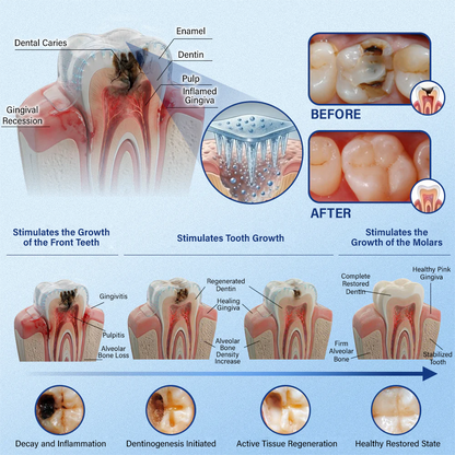 Your Smile🦷Timilk® Tooth & Gum Repair Fast-Dissolving Microneedle Patch✨ (𝟓-𝐢𝐧-𝟏 💎 𝐑𝐞𝐛𝐮𝐢𝐥𝐝 𝐄𝐧𝐚𝐦𝐞𝐥 & 𝐃𝐞𝐧𝐭𝐢𝐧 • 𝐒𝐭𝐫𝐞𝐧𝐠𝐭𝐡𝐞𝐧 𝐆𝐮𝐦𝐬 • 𝐄𝐫𝐚𝐝𝐢𝐜𝐚𝐭𝐞 𝐓𝐚𝐫𝐭𝐚𝐫 & 𝐎𝐝𝐨𝐫 • 𝐖𝐡𝐢𝐭𝐞𝐧𝐢𝐧𝐠 • 𝐒𝐭𝐨𝐩 𝐓𝐨𝐨𝐭𝐡 𝐒𝐞𝐧𝐬𝐢𝐭𝐢𝐯𝐢𝐭𝐲)