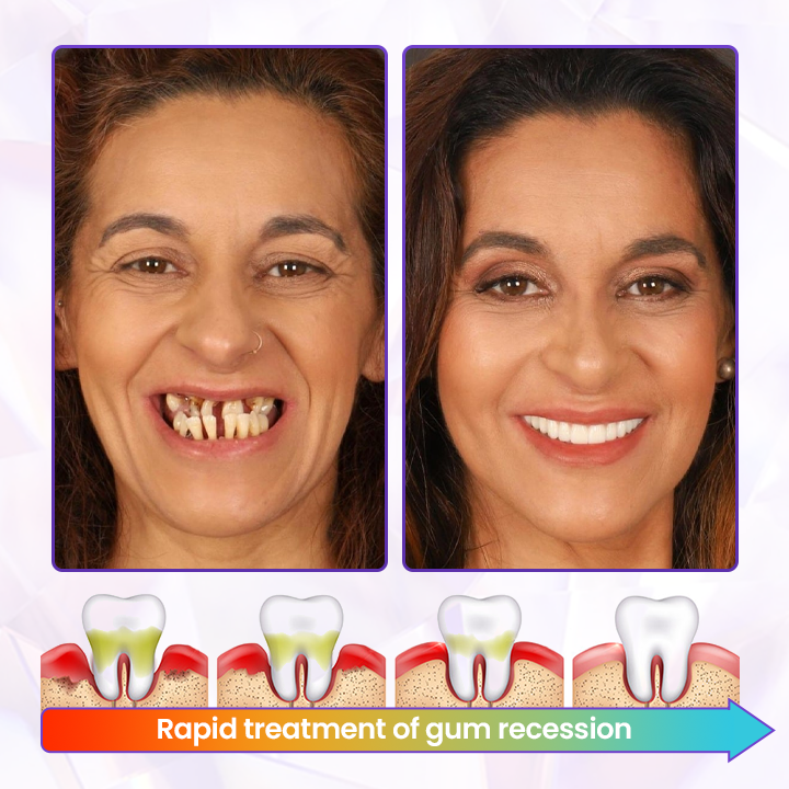 Timilk® BeeRenew Advanced Gum Healing Toothpaste