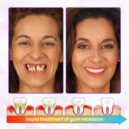 Timilk® BeeRenew Advanced Gum Healing Toothpaste