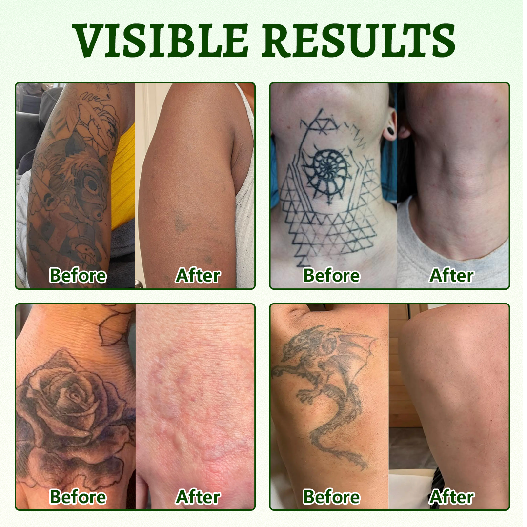 Timlk® PureAlgae Ink Removal Support Spray 🌿 — Say Goodbye to Old Tattoo Pigment 💚, Fade Stubborn Ink ✨, Repair & Smooth Treated Skin 💧, Non-Laser ✅, Try It Now! 🔥