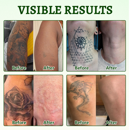 Timlk® PureAlgae Ink Removal Support Spray 🌿 — Say Goodbye to Old Tattoo Pigment 💚, Fade Stubborn Ink ✨, Repair & Smooth Treated Skin 💧, Non-Laser ✅, Try It Now! 🔥
