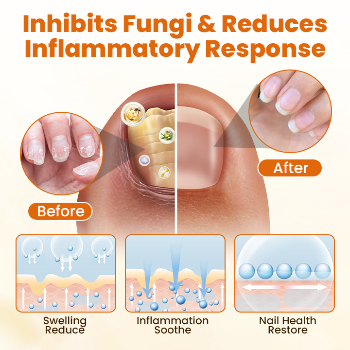 Timlk® FungiBee Advanced Nail Repair Spray