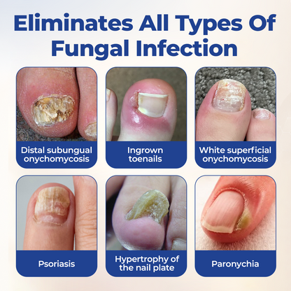 Timlk® FungiBee Advanced Nail Repair Solution