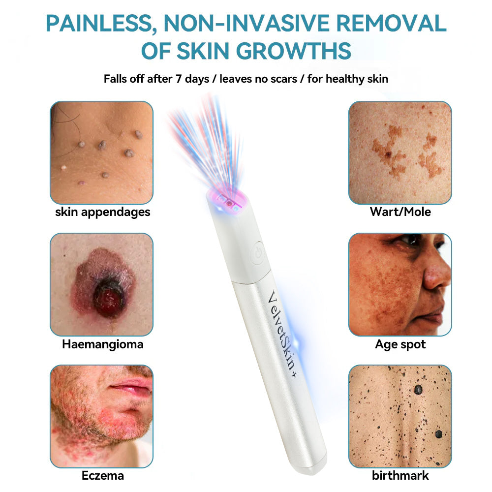 Purekin VelvetSkin+ Medical-Grade Laser Pen (Powered by CO2 laser technology – effectively removes moles, warts, skin tags, pigmentation spots, and other skin imperfections)