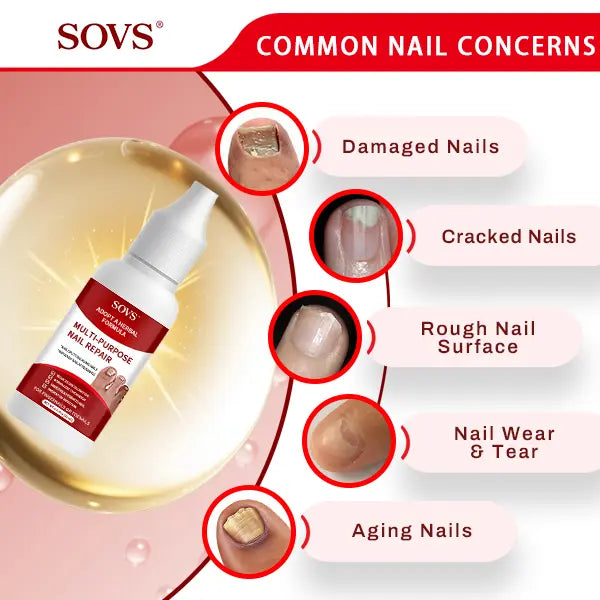 SOVS Toenail Fungus Treatment Extra Strength