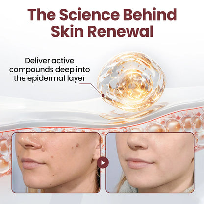 AuraGen® Double-ended wart removal pen