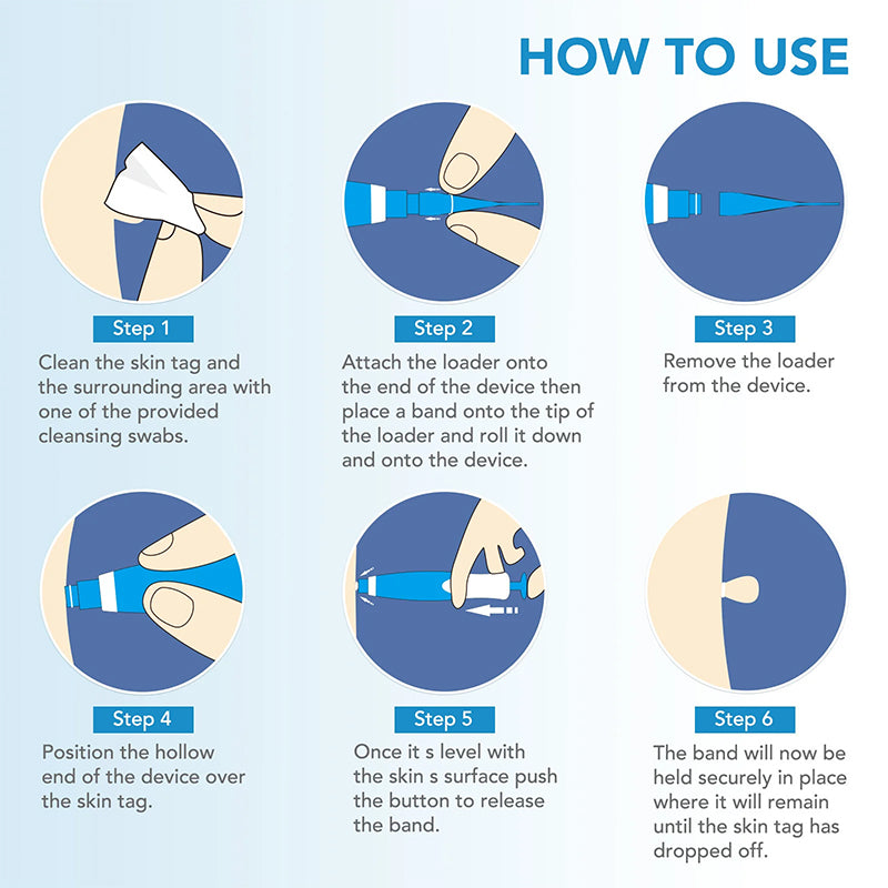 AuraGen® Double-ended wart removal pen