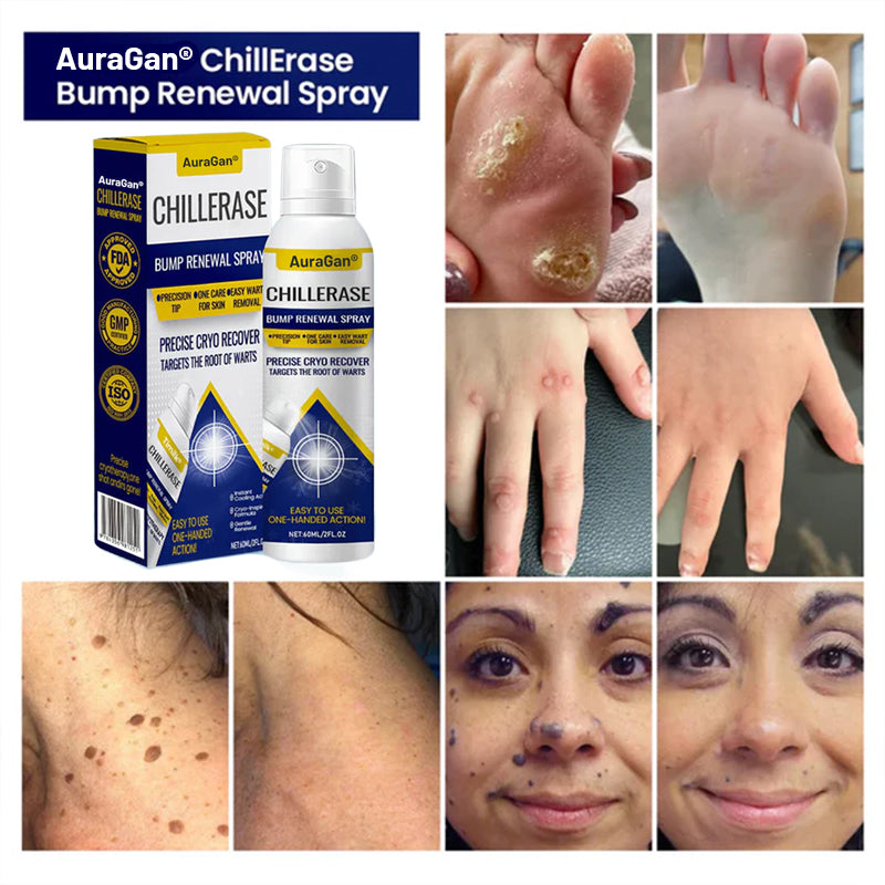 AuraGan® ChillErase Bump Renewal Spray