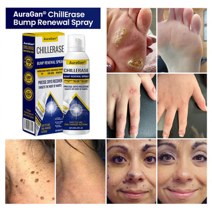 AuraGan® ChillErase Bump Renewal Spray