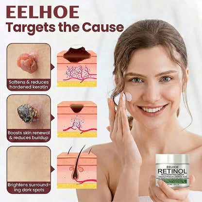 EELHOE Rejuvenating Cream
