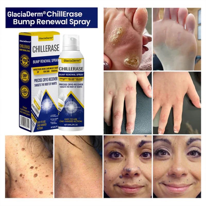 GlaciaDerm® ChillErase Bump Renewal Spray