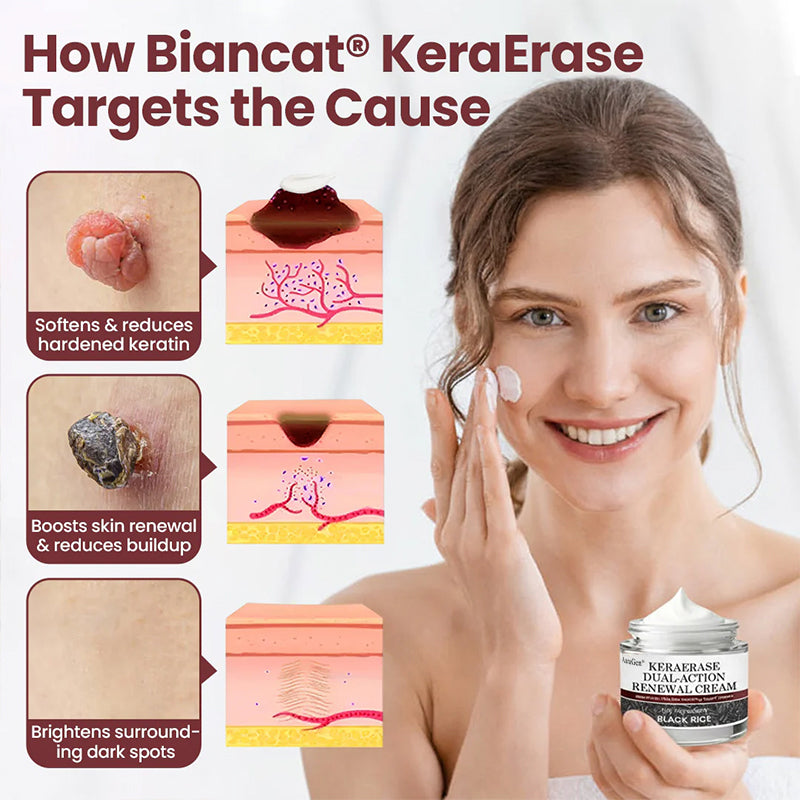 AuraGen® KeraErase Dual-Action Renewal Cream