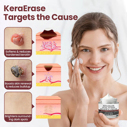 GlaciaDerm® KeraErase Dual-Action Renewal Cream