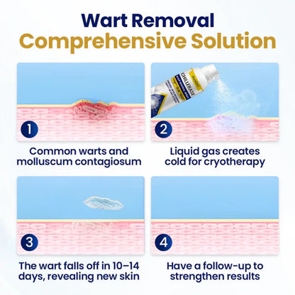 AuraGen® ChillErase Bump Renewal Spray