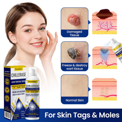 AuraGen® ChillErase Bump Renewal Spray